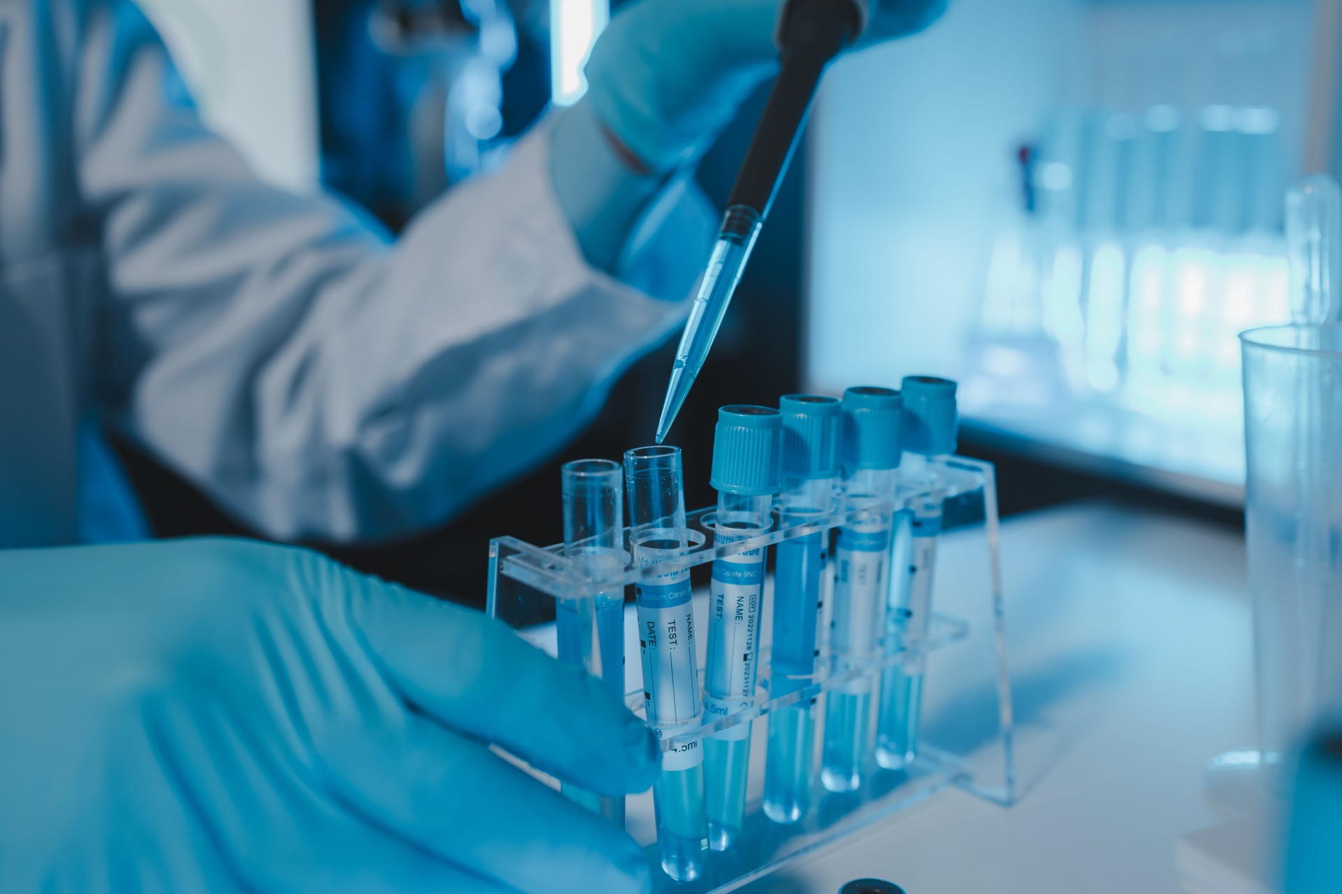 a scientist is working in a laboratory, a chemical researcher is preparing sample for a vaccine against a virus, work in lab concentrate is the most important because chemicals are dangerous